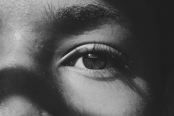 The Truth About Dry Eyes and LASIK: Who Should Be Cautious featured image
